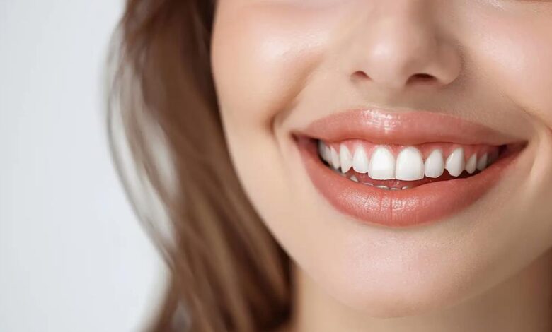 diş beyazlatma, diş beyazlatma fiyatları, gülüş tasarımı (1)